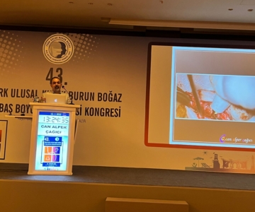 43rd National Congress of Turkish Society of Otorhinolaryngology & Head and Neck Surgery / 16-20 November 2022￼