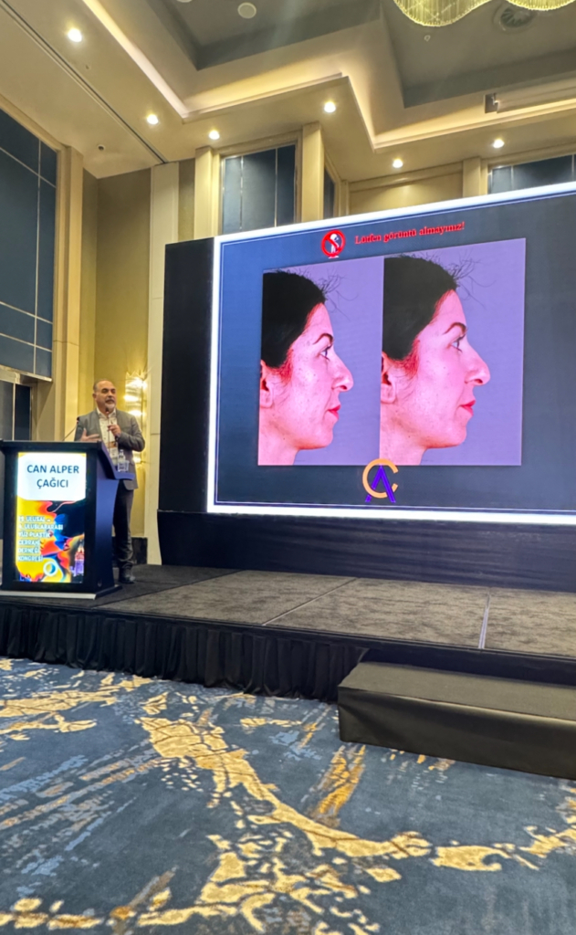 Tipplasti Adana Burun Estetiği