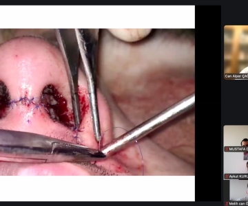 Yüz Plastik Cerrahi Okulu / 20 Aralık 2025 / Online