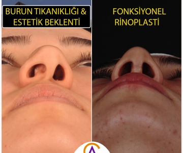 Fonksiyonel