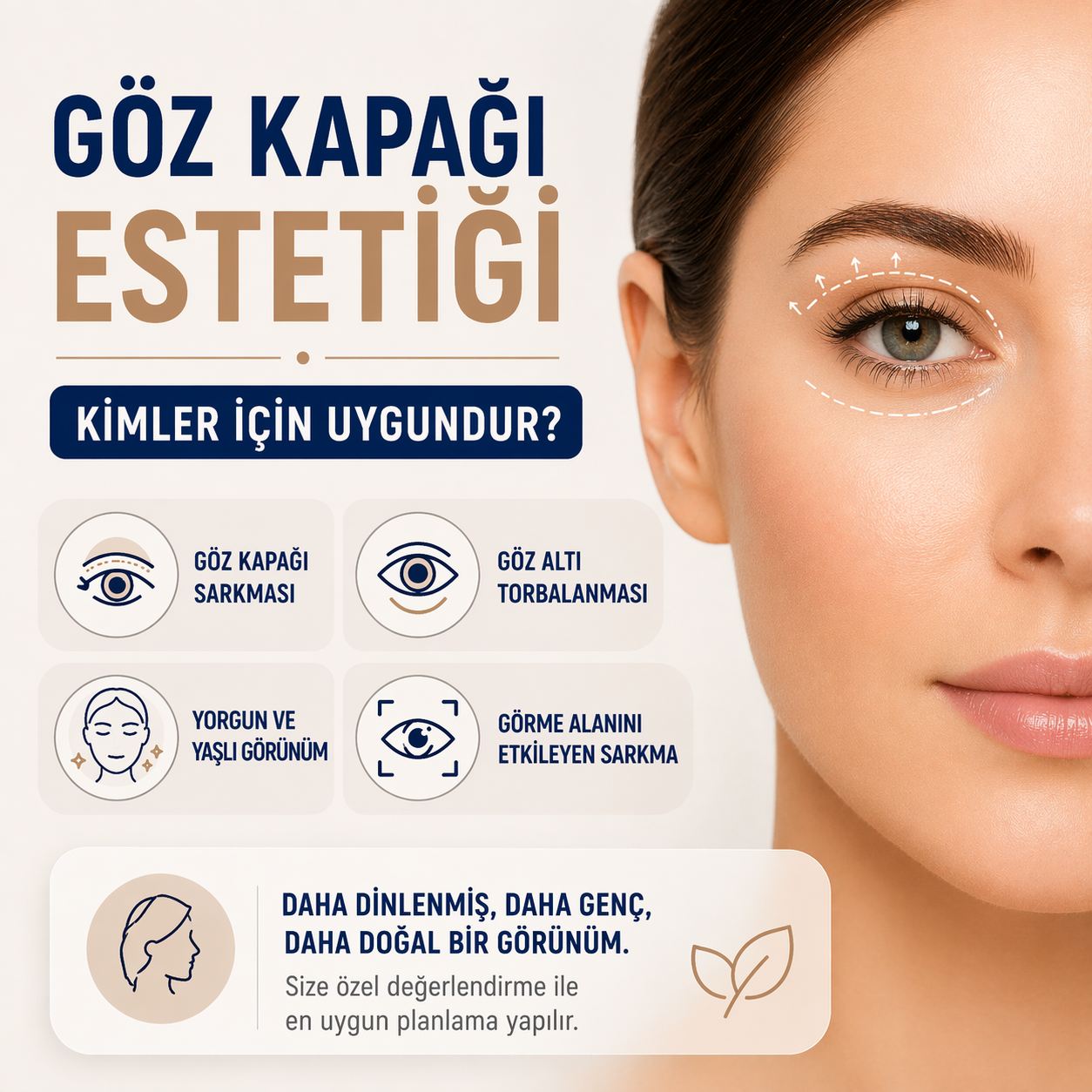 Göz Kapağı Estetiği (Blefaroplasti) Kimler İçin Uygundur? 