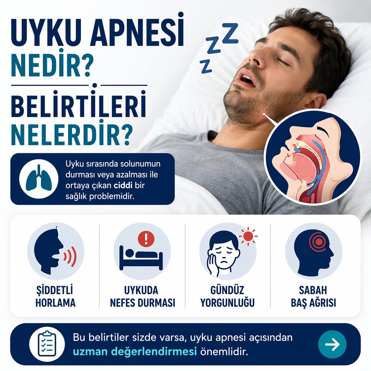 Uyku Apnesi Nedir? Belirtileri Nelerdir? 