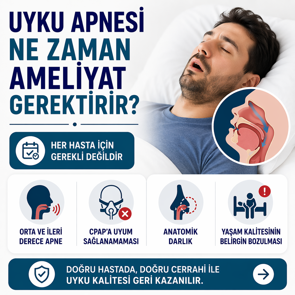 Uyku Apnesi Ne Zaman Ameliyat Gerektirir? 