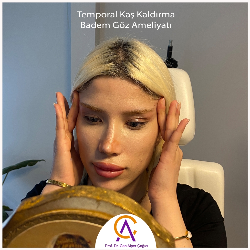 Adana Temporal kaş kaldrıma ve Badem göz ameliyatı